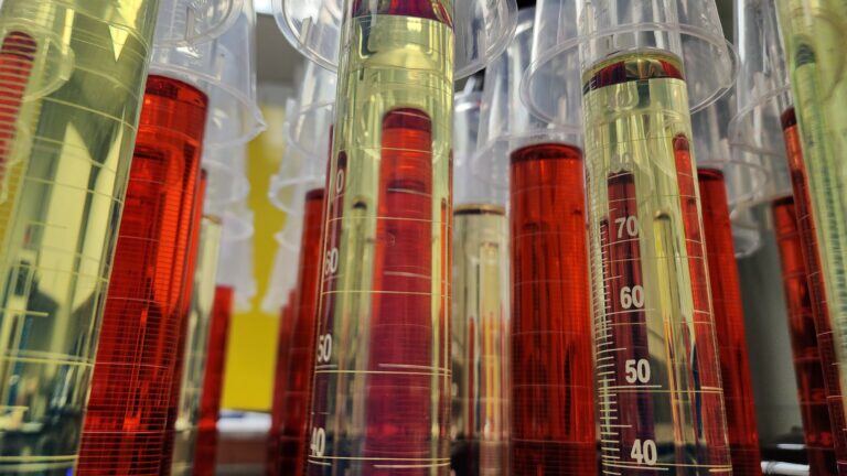 Oil Analysis by Eurofins TestOil